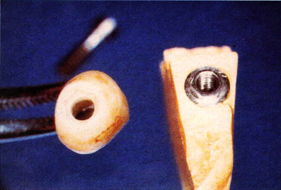 fig. I