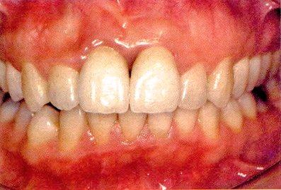 fig. 13