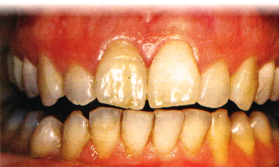 fig. 9